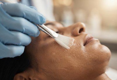 Acne Treatment_img