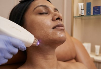 Face Laser Hair Reduction_img