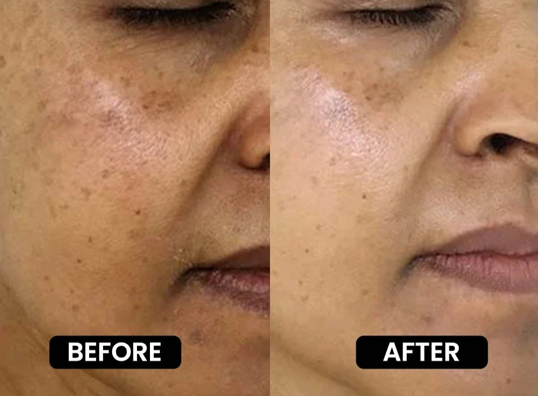 before-after3